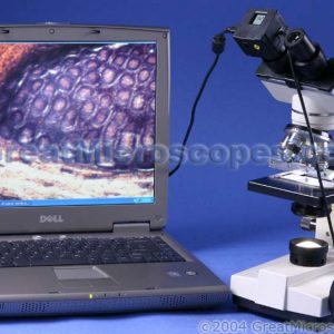 USB computer connected camera not included. Computer/Laptop not included. Shape of microscope camera may vary from what is shown.
